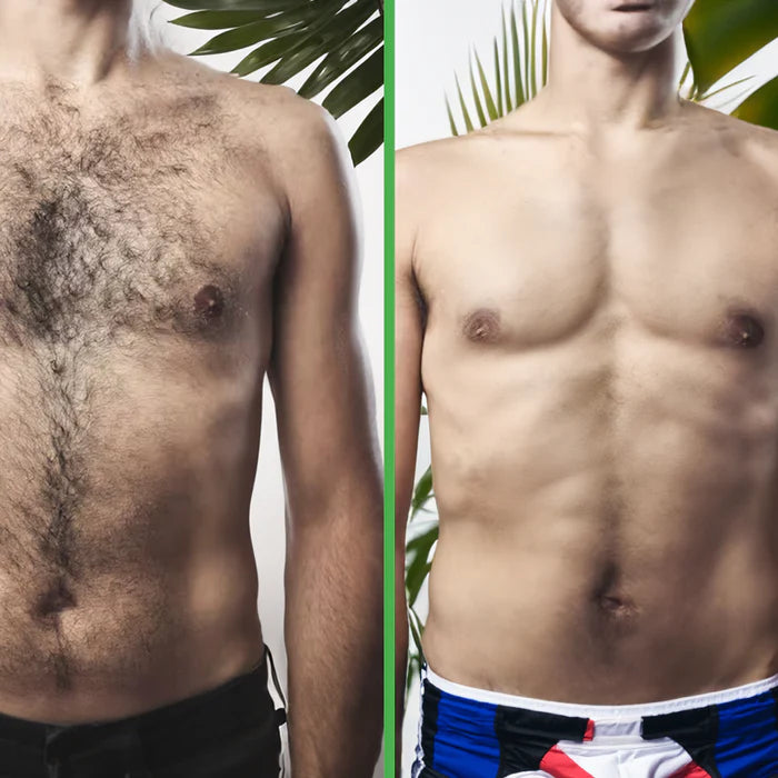 Shalommy Benefits Of ipl Hair Removal Image 1 Shalommy